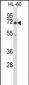 BTK Antibody (N-term)
